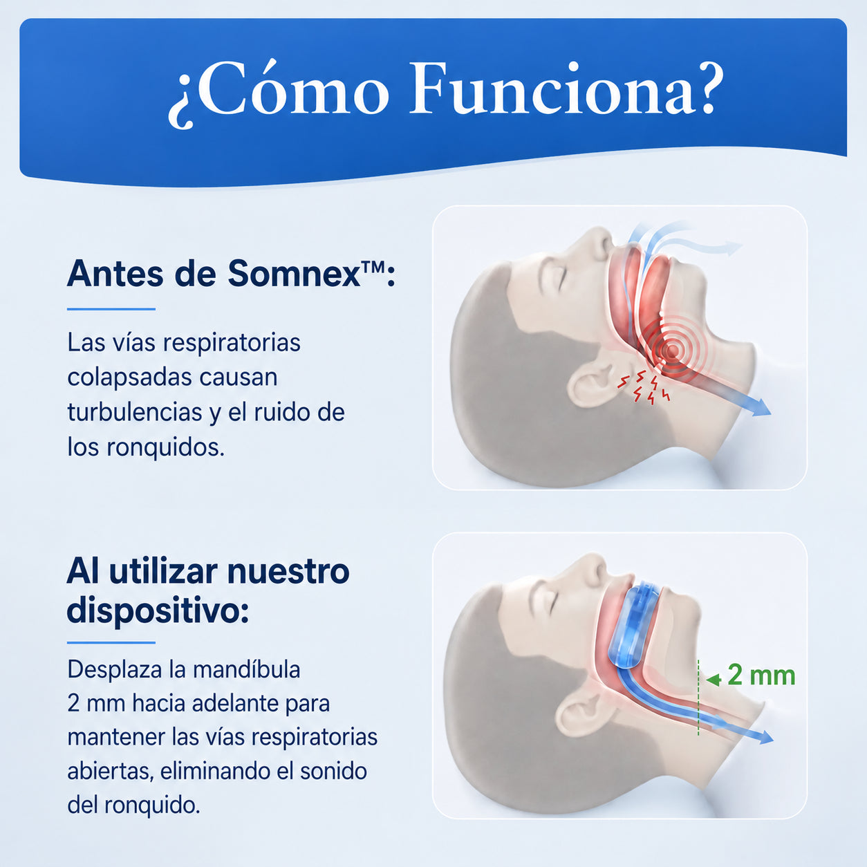 Somnex™                                        Anti-Ronquidos