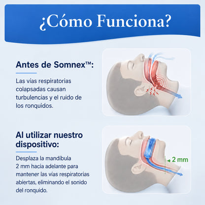 Somnex™                                        Anti-Ronquidos